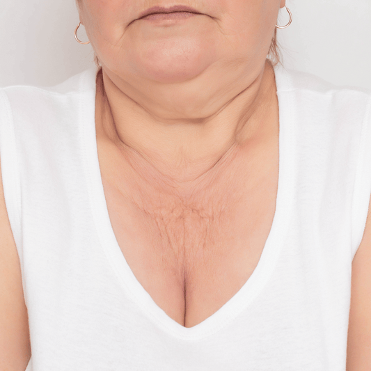 Sagging breasts