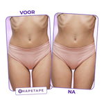 Camel Toe Pads